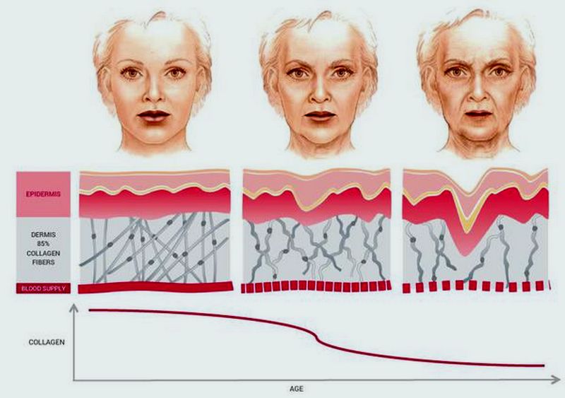 Early aging of the face as a result of our bad habits